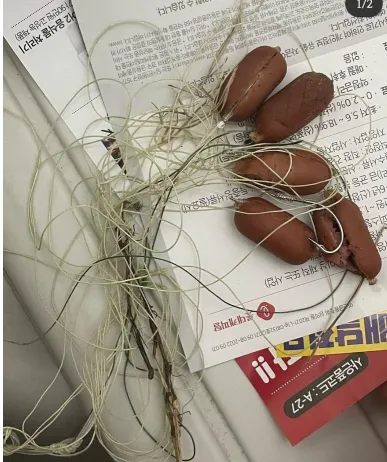 부평공원에서 발견된 소시지 사건 ㄷㄷㄷ